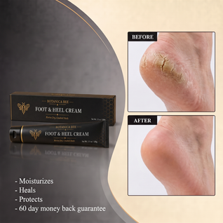 Botanica Bee Foot and Heel Cream